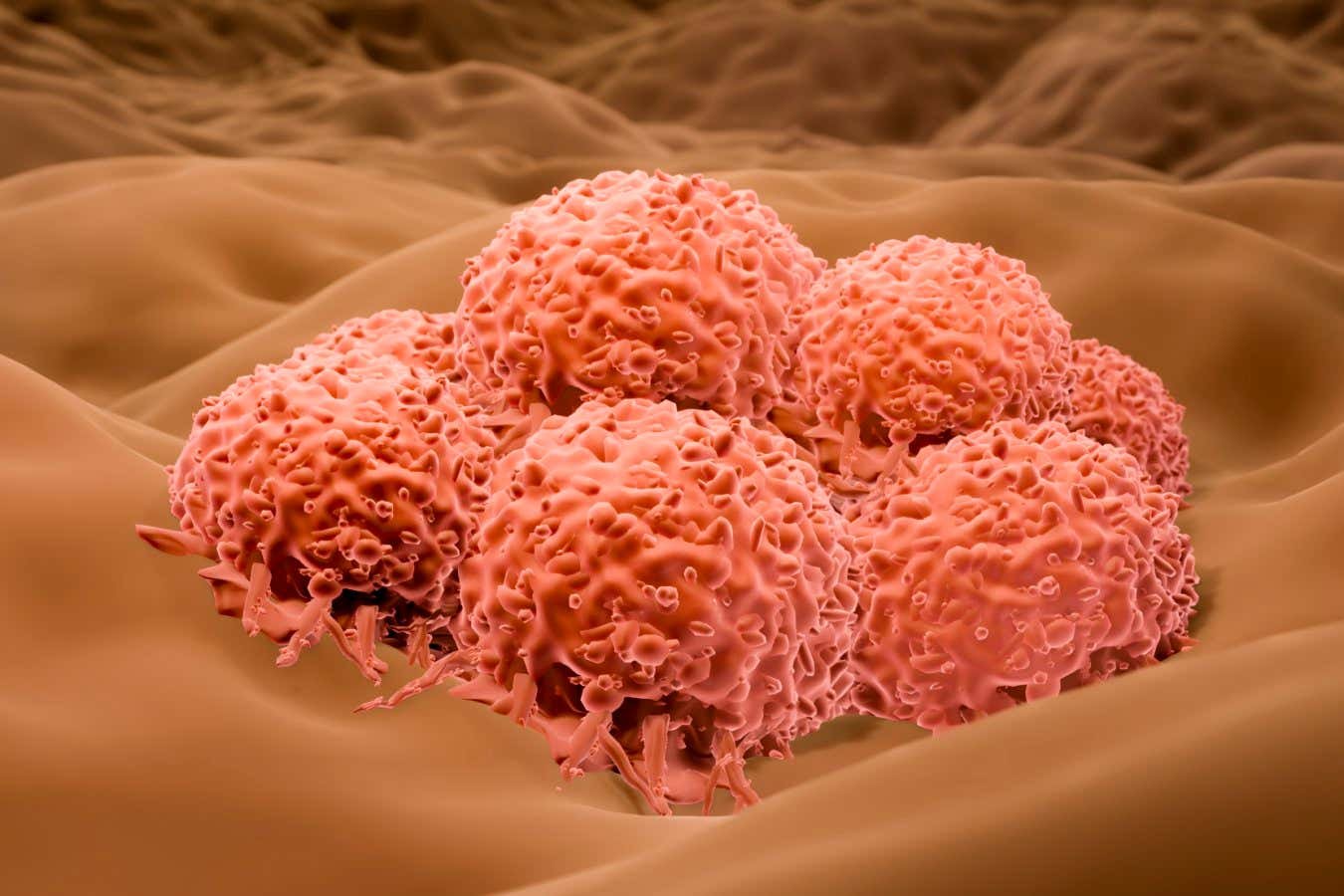 Herpes -Virus could soon be approved for the treatment of severe skin cancer